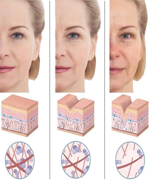 Aging