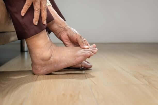 Feet-Swollen