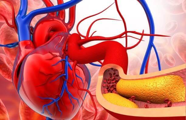 Heart-Disease