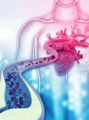Heart-Disease