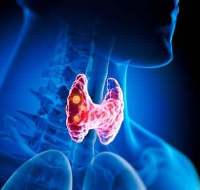 Thyroid