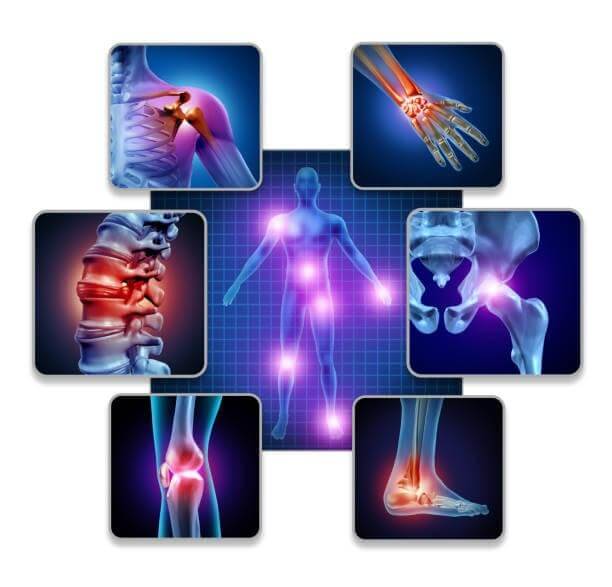 Inflammation