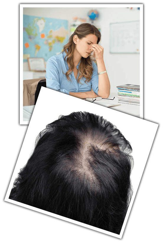 hair-fatigue